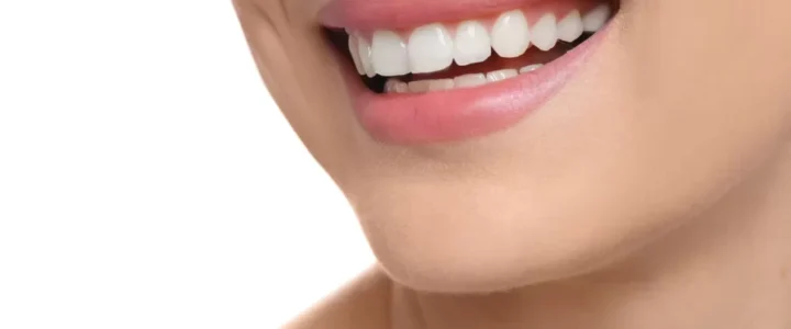 hollywood-smile